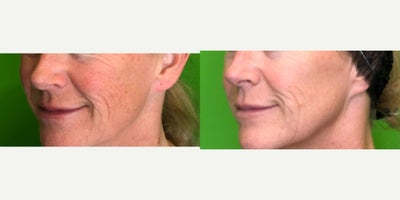 before and after image