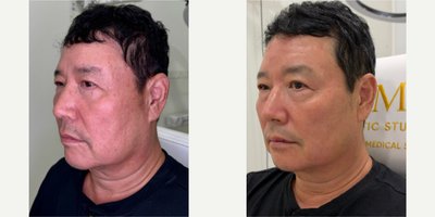 before and after image