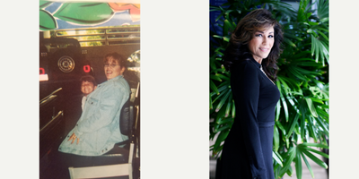 Gastric Sleeve Surgery before and after photo