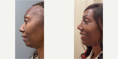 before and after image