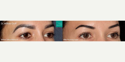 before and after image