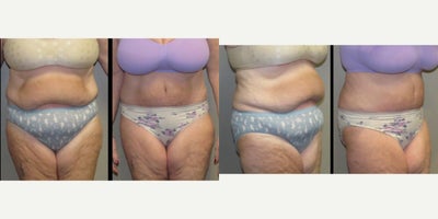 before and after image