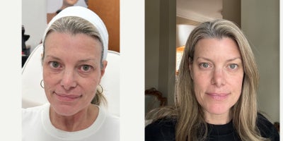 before and after image