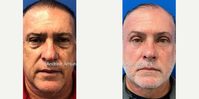 before and after image