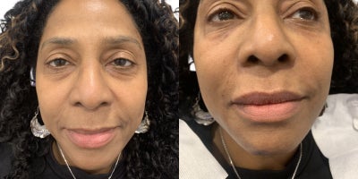 before and after image