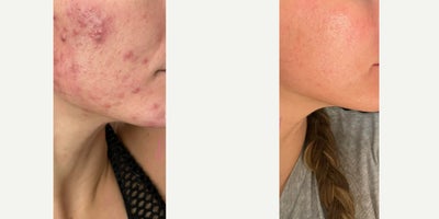 before and after image