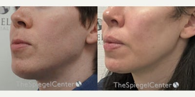 before and after image