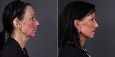 before and after image
