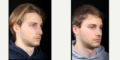 before and after image