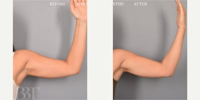 before and after image