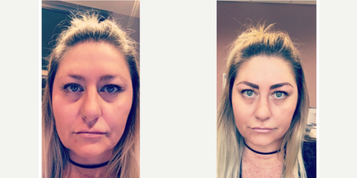 Microblading before and after photo