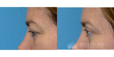 before and after image