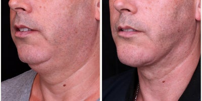before and after image