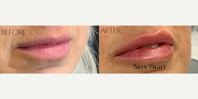 before and after image