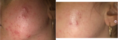 before and after image