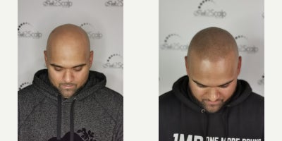 before and after image