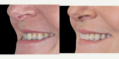 before and after image