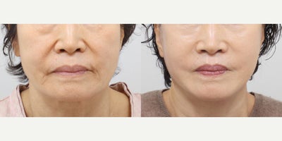 before and after image