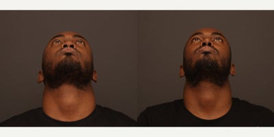 before and after image
