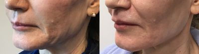 before and after image