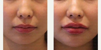 before and after image