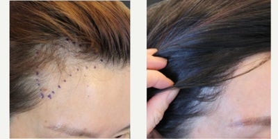 before and after image