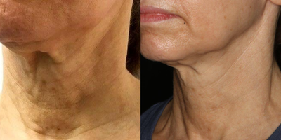 before and after image