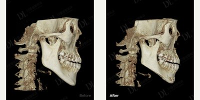 before and after image