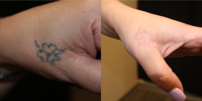 before and after image