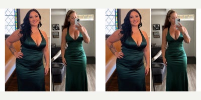 Brazilian Butt Lift before and after photo