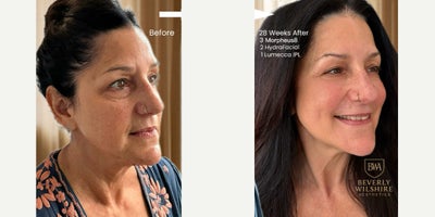 before and after image