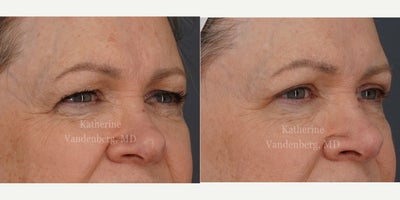 before and after image