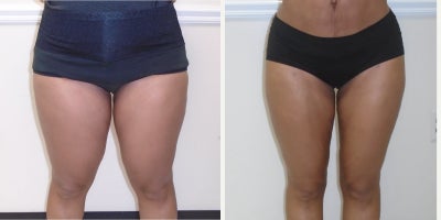 before and after image