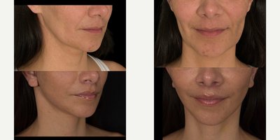 before and after image