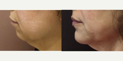 before and after image