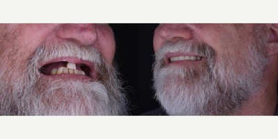 before and after image