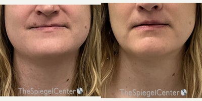 before and after image