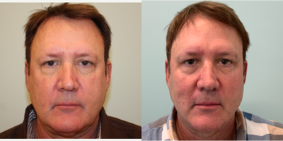 before and after image