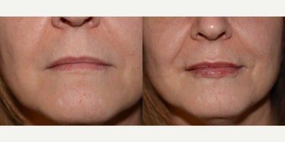 before and after image
