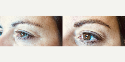 Microblading before and after photo
