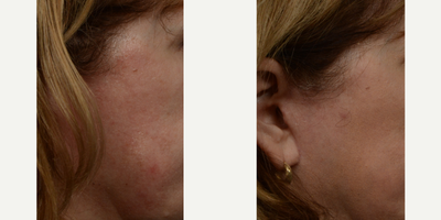 before and after image