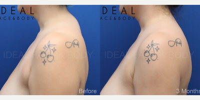 before and after image