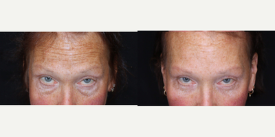 before and after image