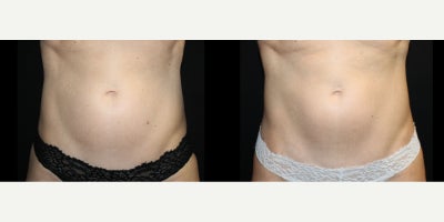 before and after image
