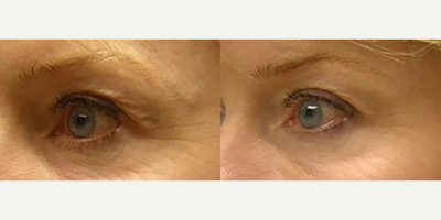 before and after image