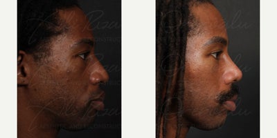 before and after image
