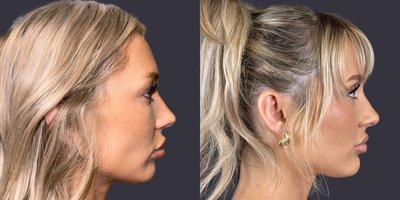 before and after image
