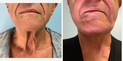 before and after image
