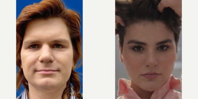 before and after image