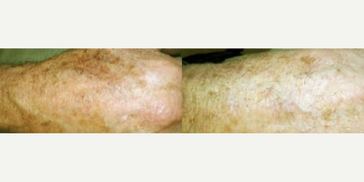 before and after image